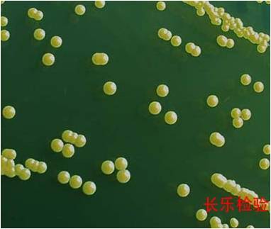 醫(yī)藥行業(yè)：人體存有金黃色葡萄球菌為正常現(xiàn)象
